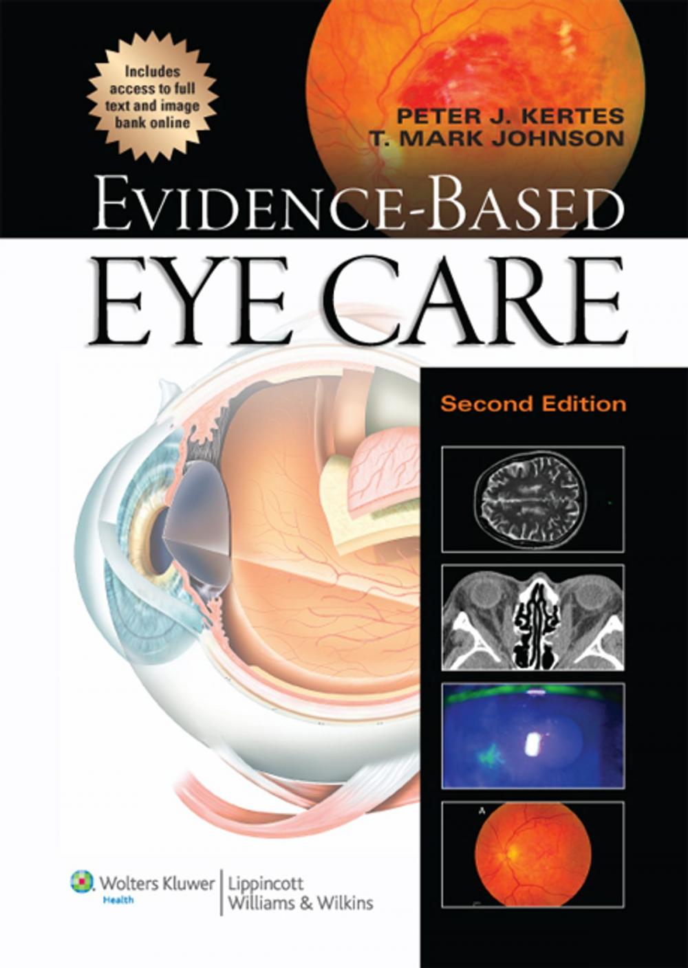 Big bigCover of Evidence-Based Eye Care