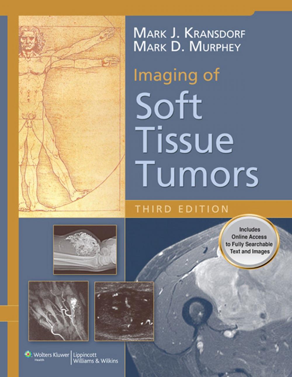 Big bigCover of Imaging of Soft Tissue Tumors