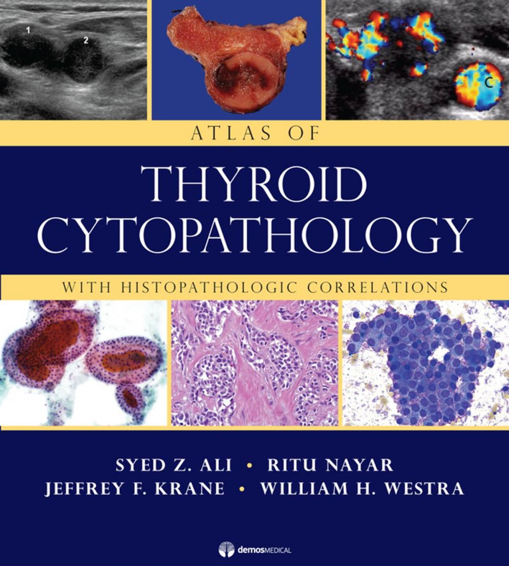 Big bigCover of Atlas of Thyroid Cytopathology