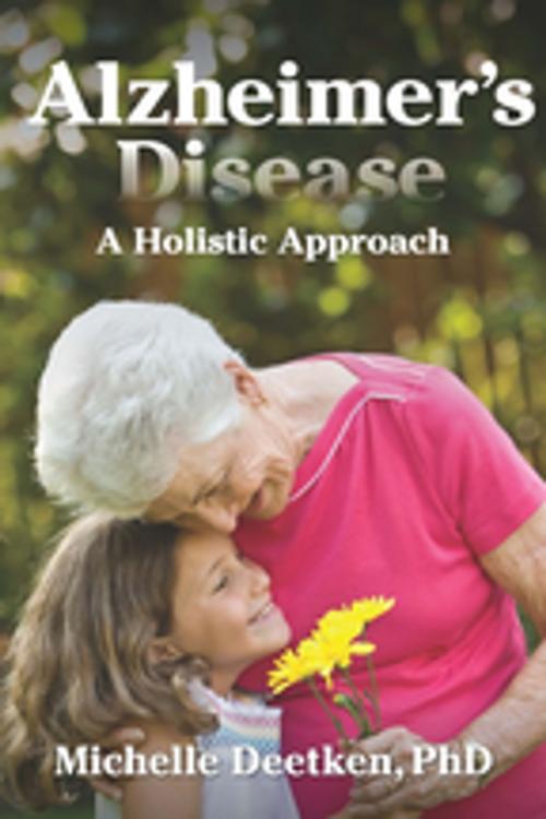 Cover of the book Alzheimer's Disease by Michelle Deetken, PhD, A.R.E. Press