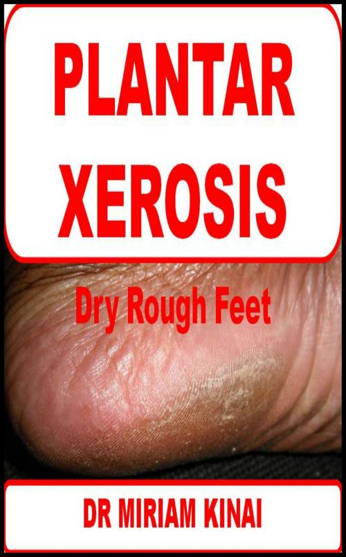 Cover of the book Plantar Xerosis by Miriam Kinai, Miriam Kinai