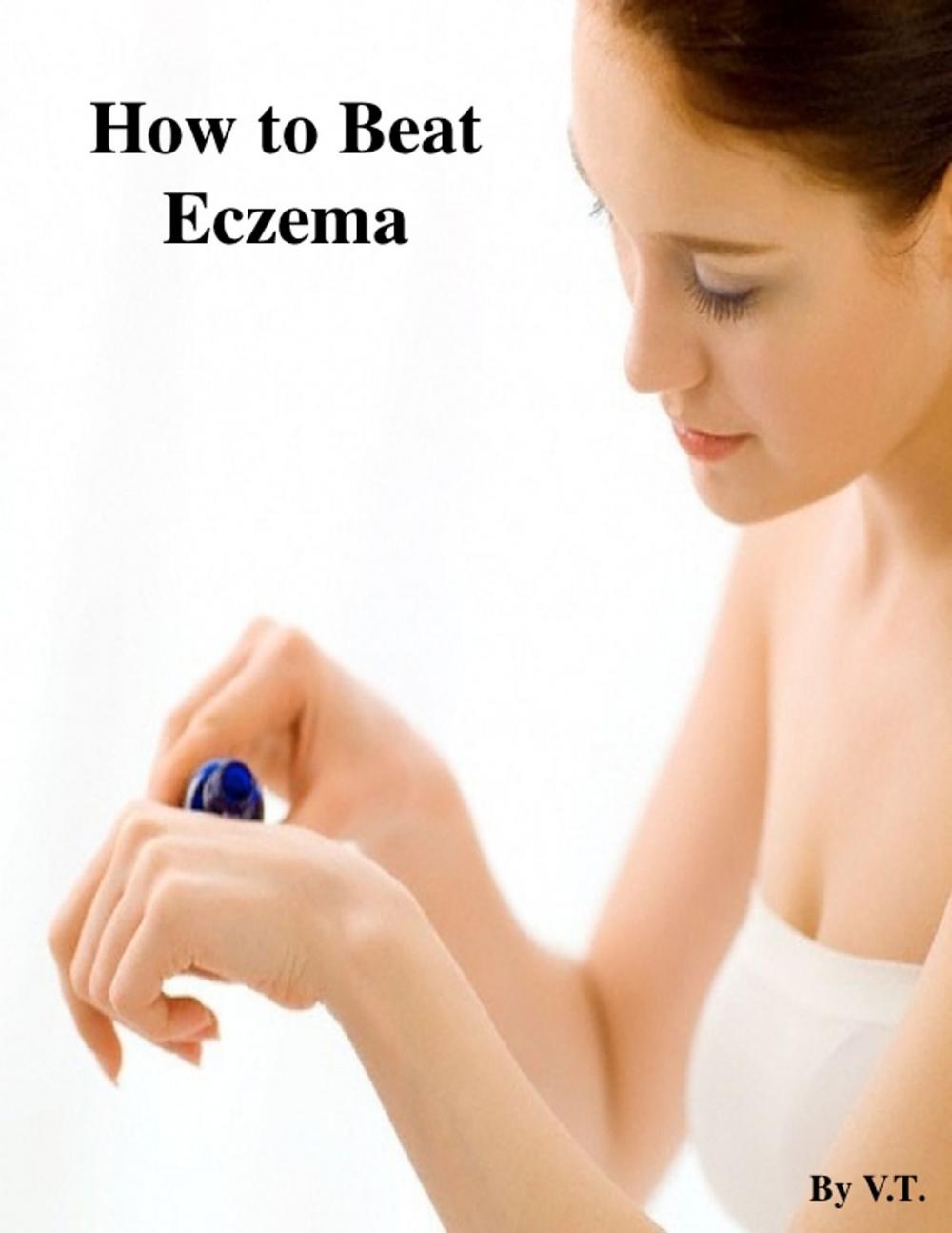 Big bigCover of Cure Your Eczema Permanently