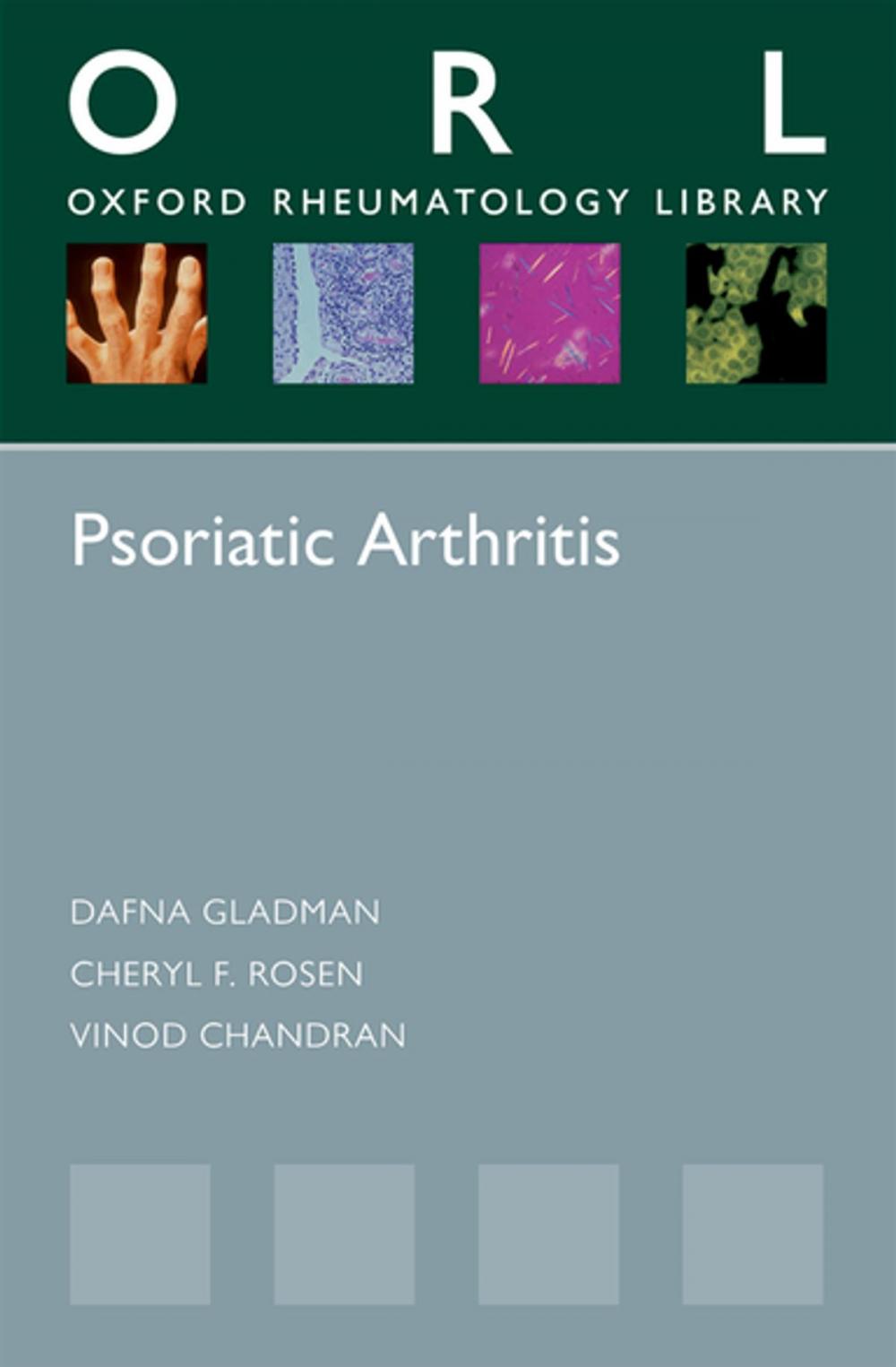 Big bigCover of Psoriatic Arthritis