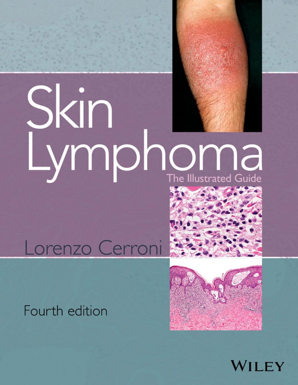 Big bigCover of Skin Lymphoma