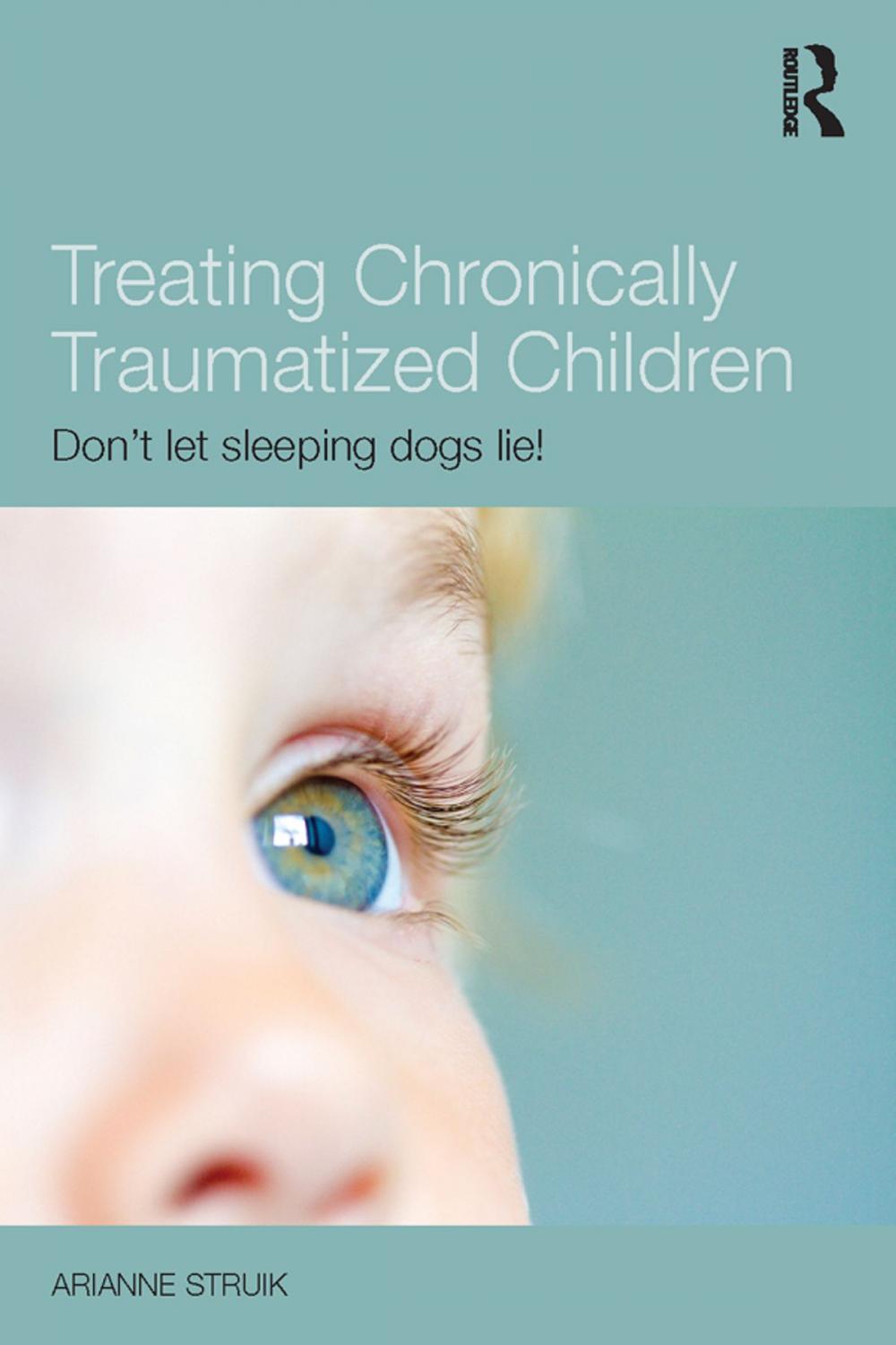 Big bigCover of Treating Chronically Traumatized Children