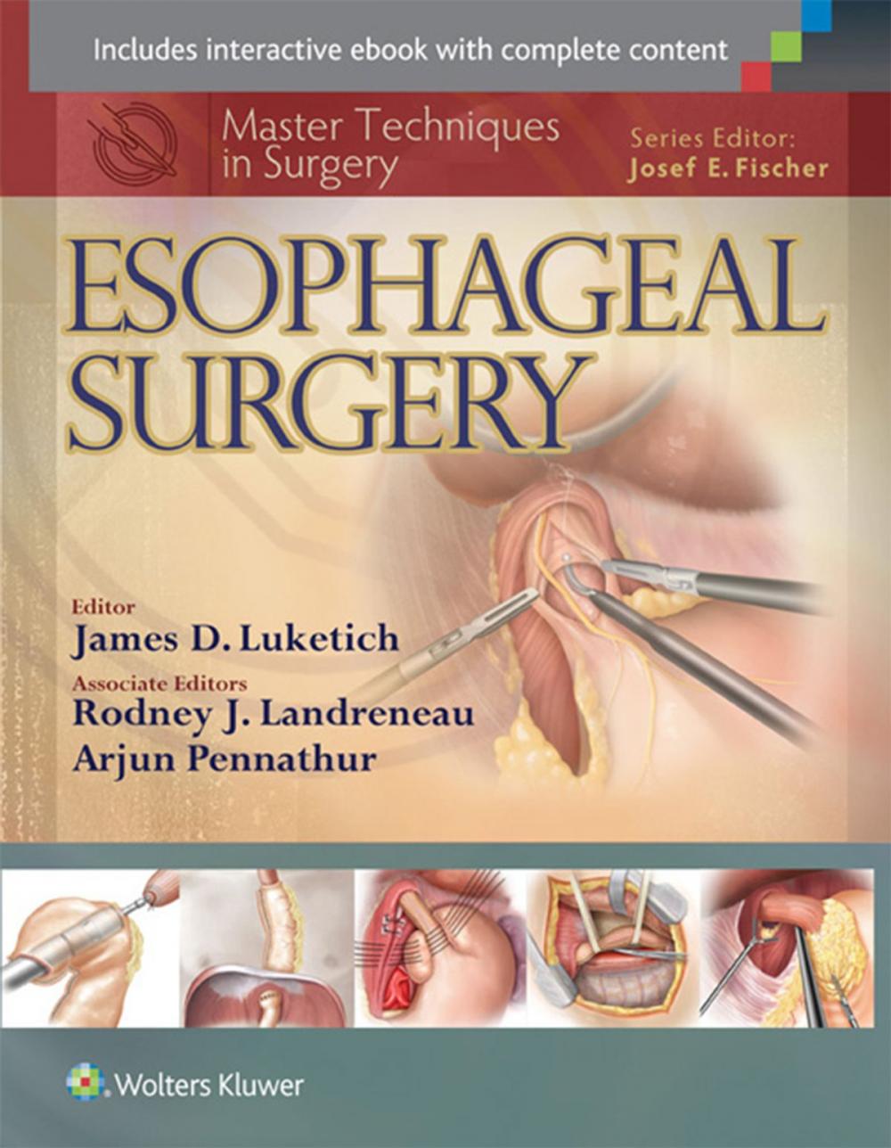 Big bigCover of Master Techniques in Surgery: Esophageal Surgery