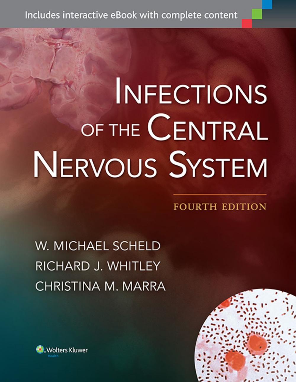 Big bigCover of Infections of the Central Nervous System