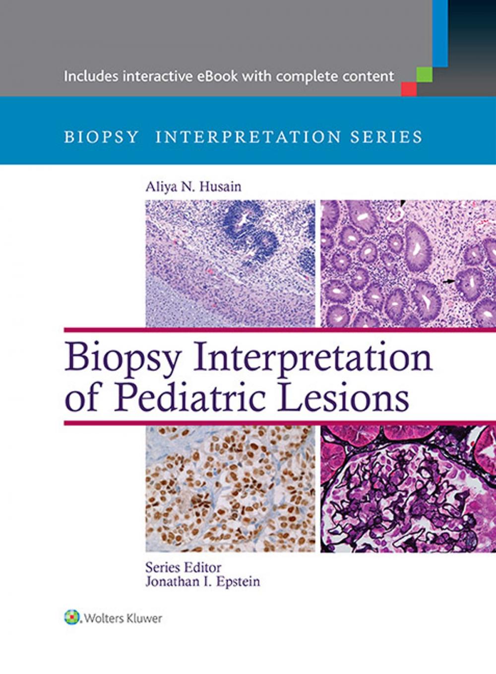 Big bigCover of Biopsy Interpretation of Pediatric Lesions