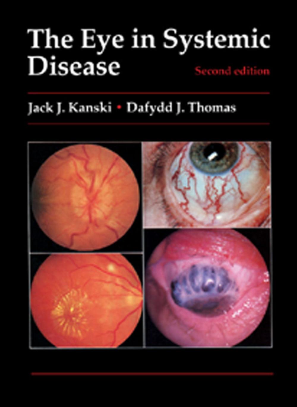 Big bigCover of The Eye in Systemic Disease