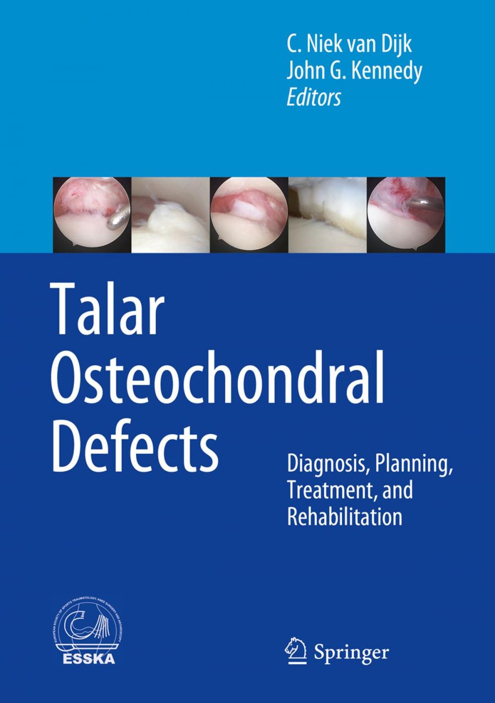 Big bigCover of Talar Osteochondral Defects