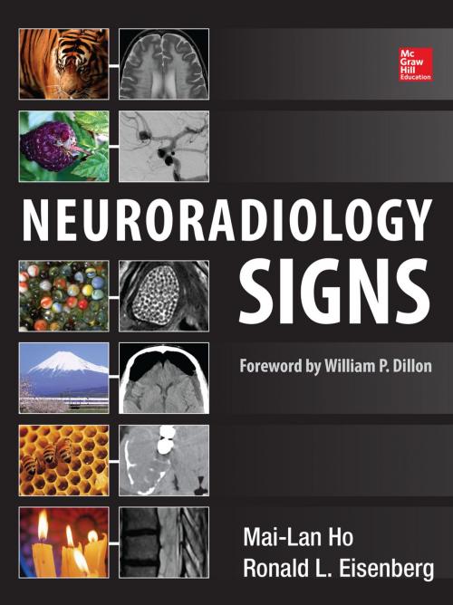 Cover of the book Neuroradiology Signs by Mai-Lan Ho, Ronald L. Eisenberg, McGraw-Hill Education
