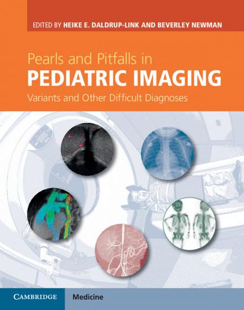 Cover of the book Pearls and Pitfalls in Pediatric Imaging by , Cambridge University Press