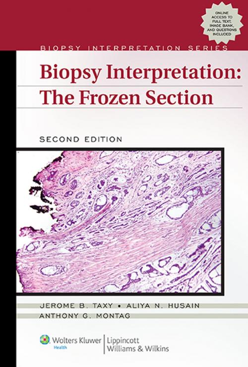 Cover of the book Biopsy Interpretation: The Frozen Section by Jerome B. Taxy, Wolters Kluwer Health