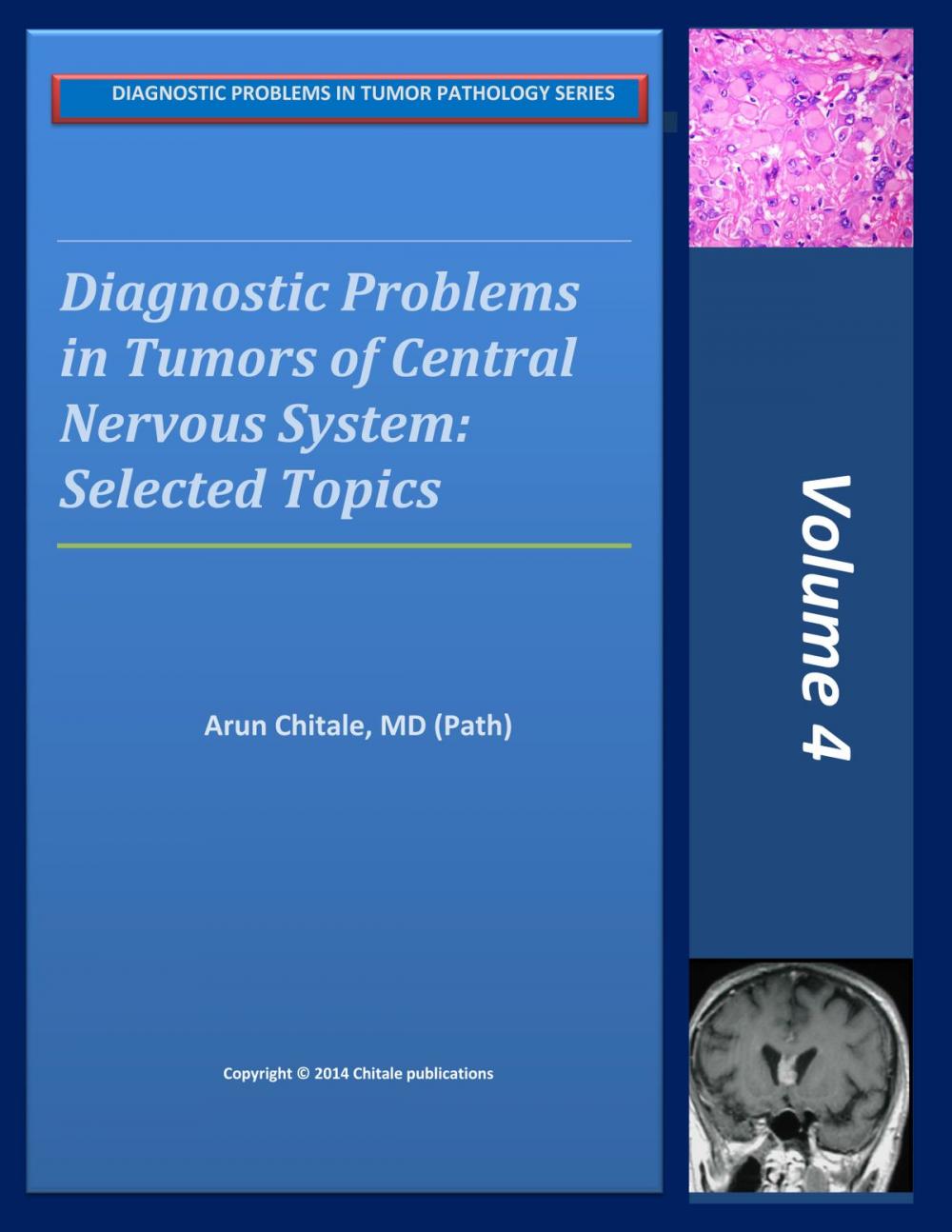 Big bigCover of Diagnostic Problems in Tumors of Central Nervous System: Selected Topics