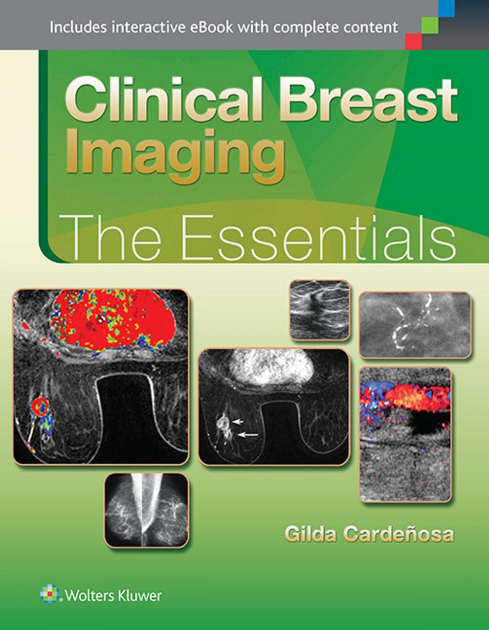 Big bigCover of Clinical Breast Imaging: The Essentials