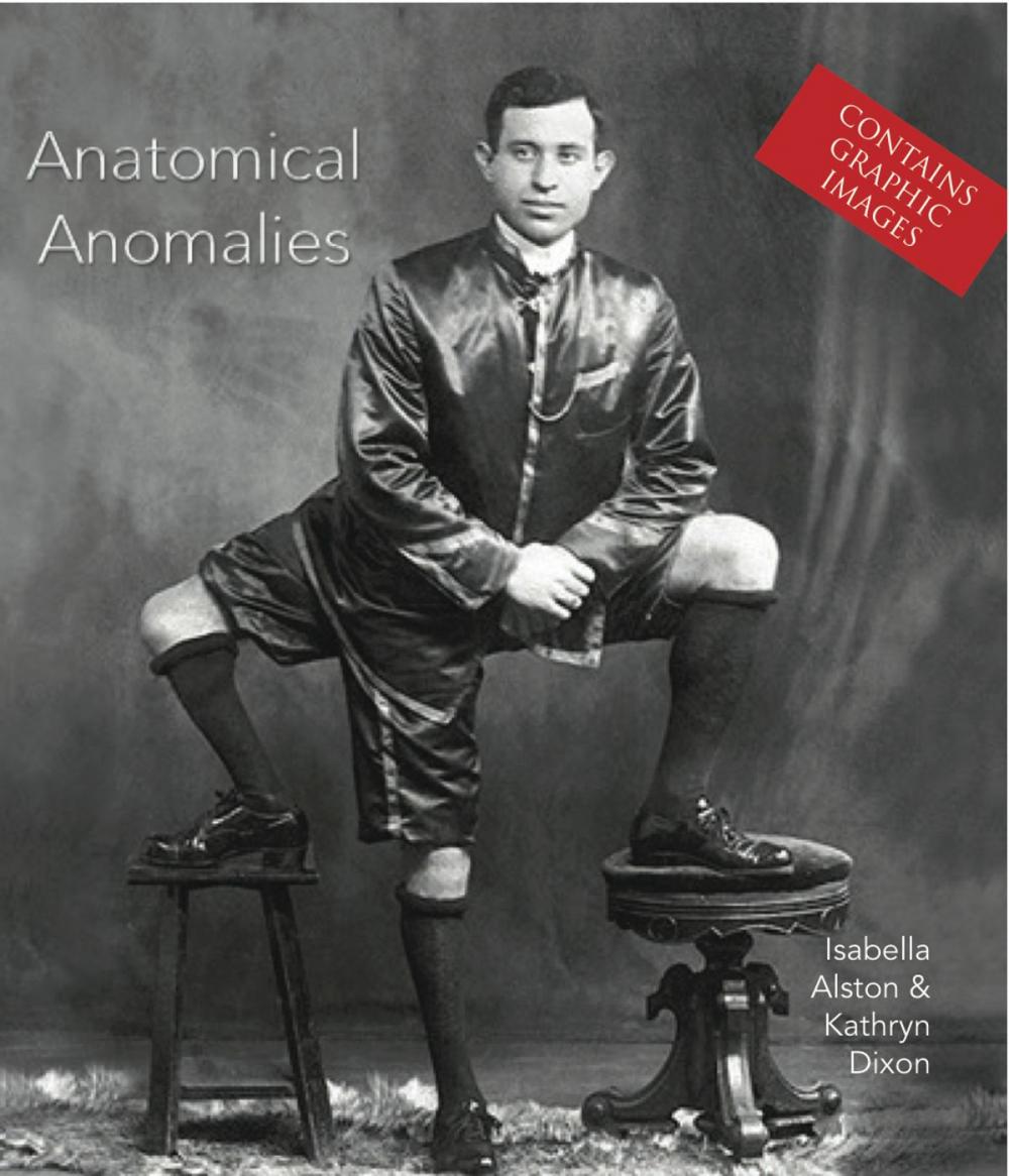 Big bigCover of Anatomical Anomalies