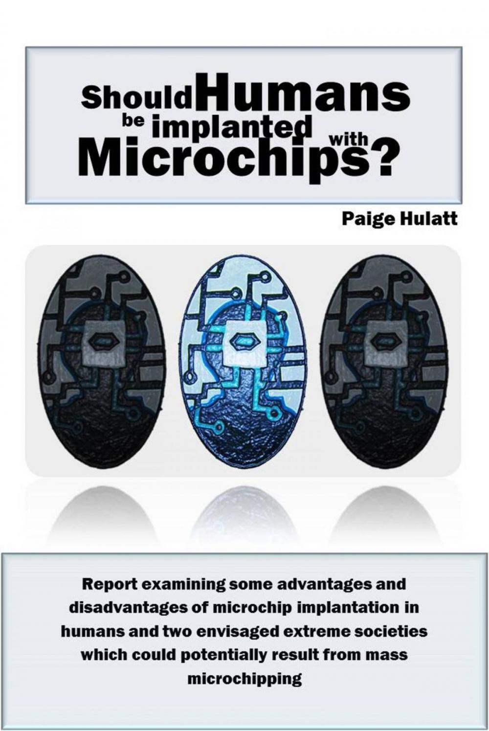 Big bigCover of Should Humans be Implanted with Microchips?