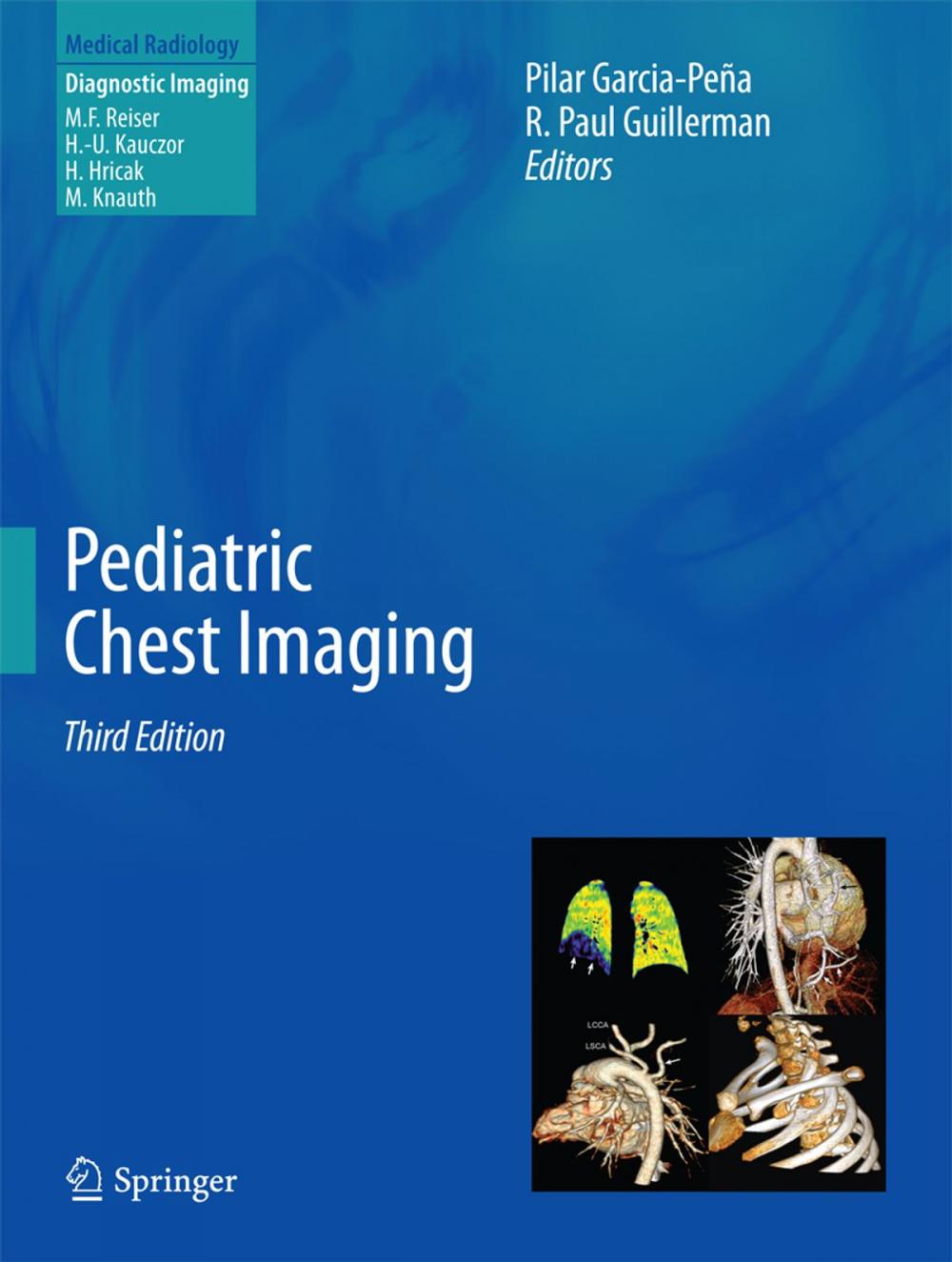 Big bigCover of Pediatric Chest Imaging