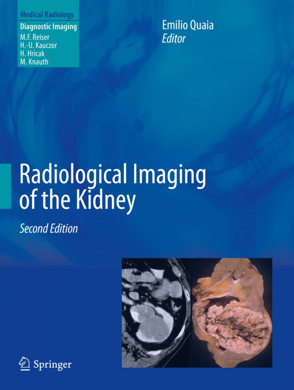 Big bigCover of Radiological Imaging of the Kidney