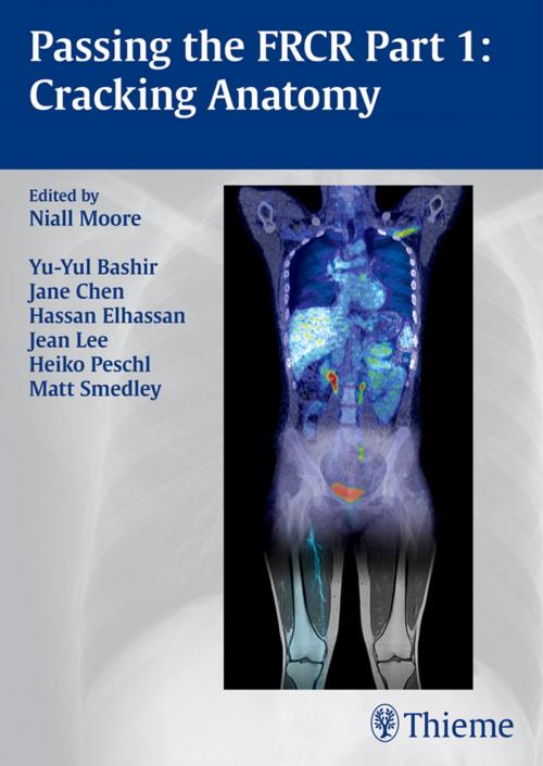 Cover of the book Passing the FRCR Part 1: Cracking Anatomy by Niall Moore, Thieme