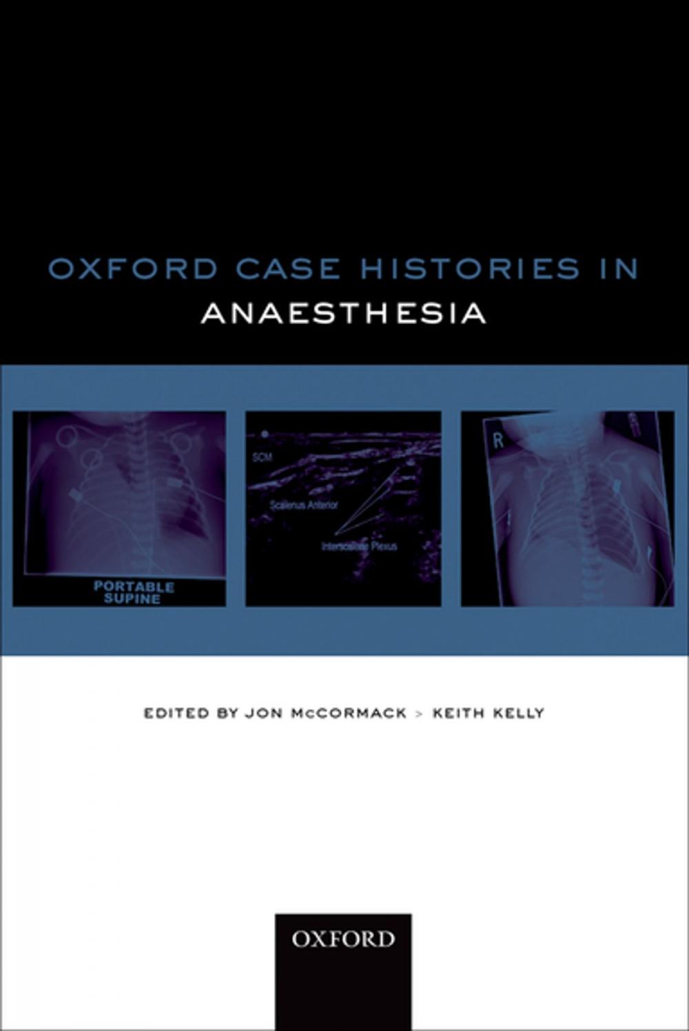 Big bigCover of Oxford Case Histories in Anaesthesia