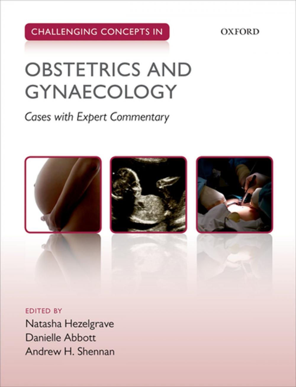 Big bigCover of Challenging Concepts in Obstetrics and Gynaecology