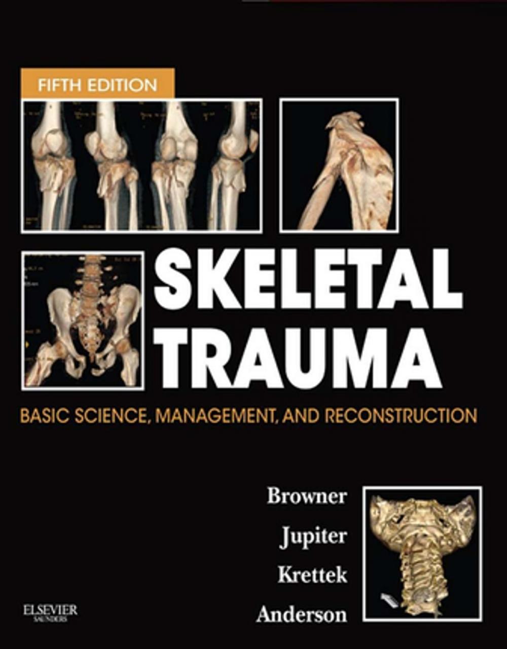 Big bigCover of Skeletal Trauma E-Book