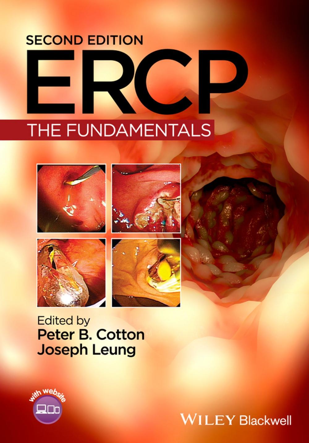 Big bigCover of ERCP, Enhanced Edition