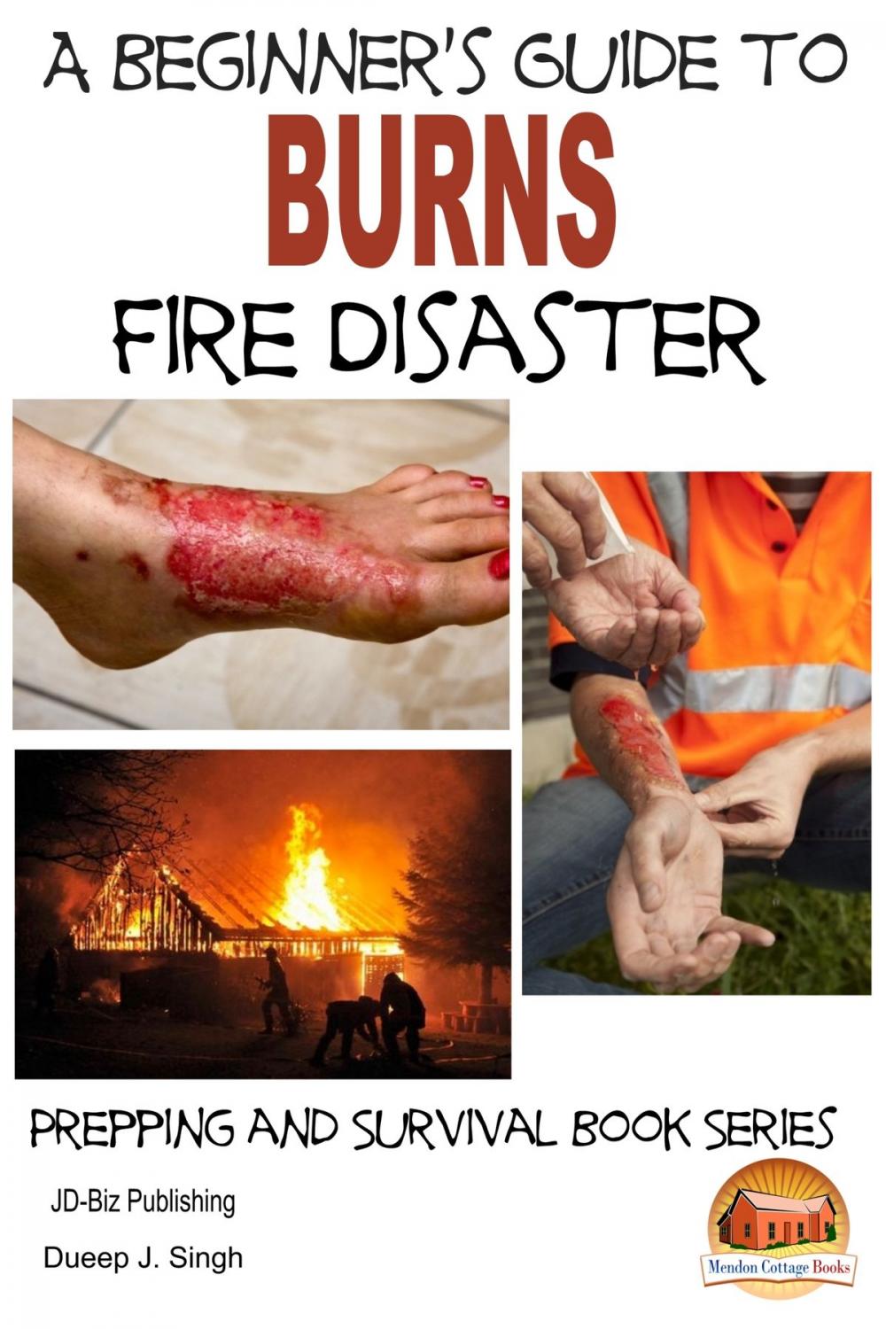 Big bigCover of A Beginner's Guide to Burns: Fire Disaster