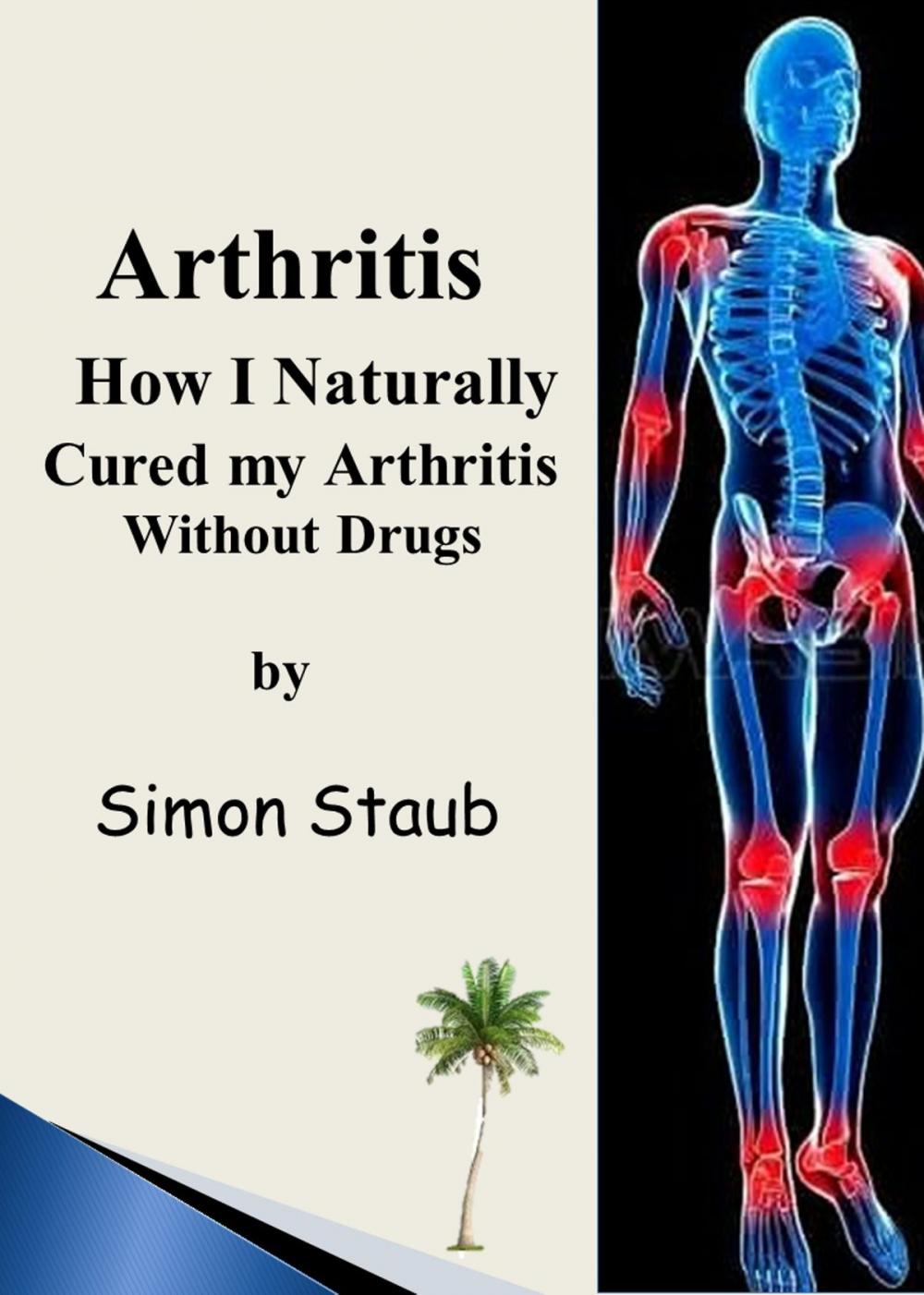 Big bigCover of Arthritis How I Naturally Cured My Arthritis Without Drugs