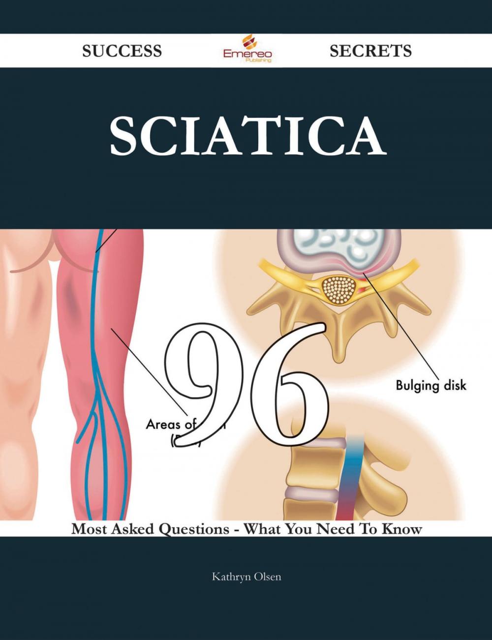 Big bigCover of Sciatica 96 Success Secrets - 96 Most Asked Questions On Sciatica - What You Need To Know