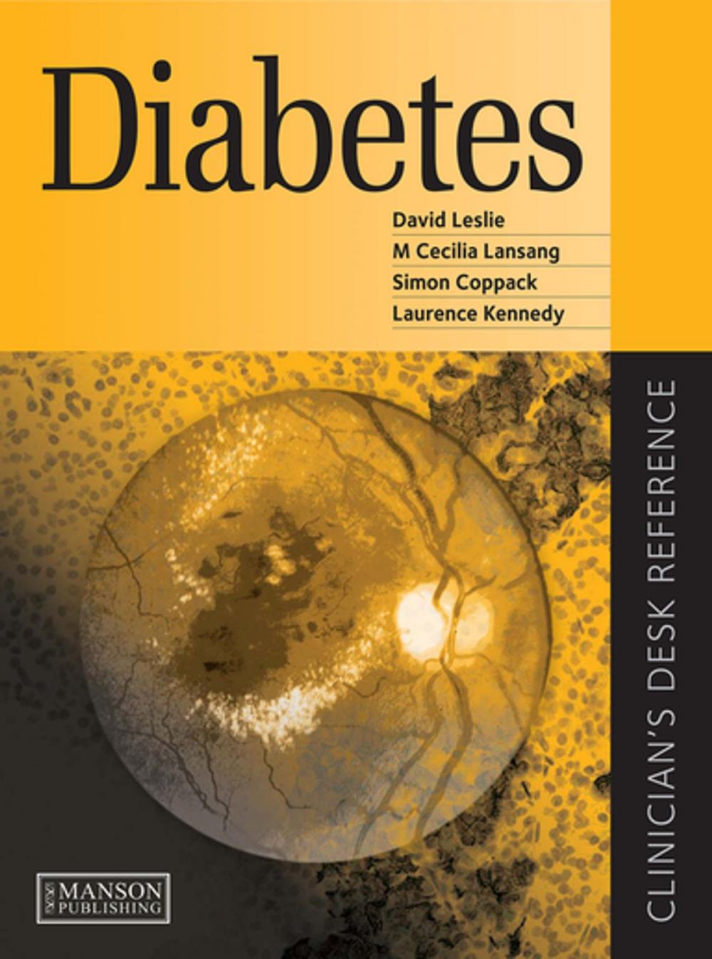 Big bigCover of Diabetes