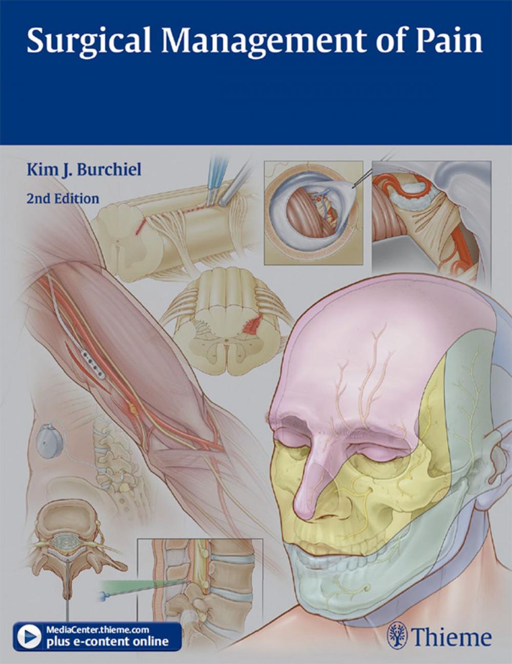 Big bigCover of Surgical Management of Pain