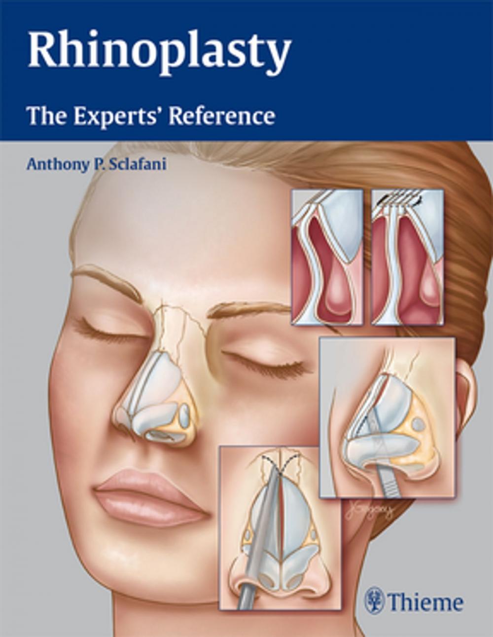 Big bigCover of Rhinoplasty