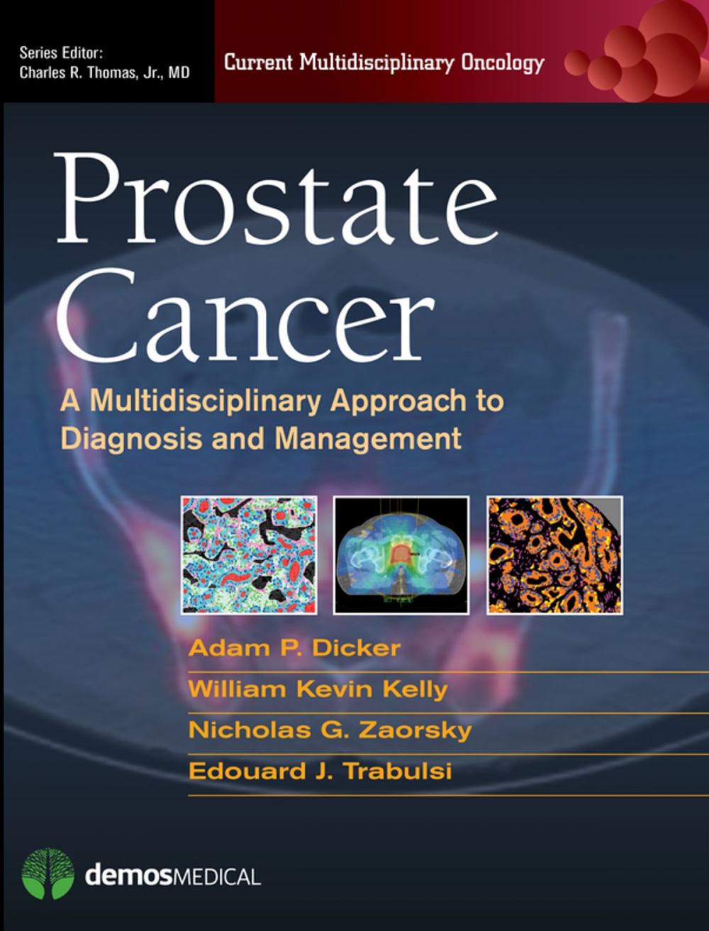 Big bigCover of Prostate Cancer