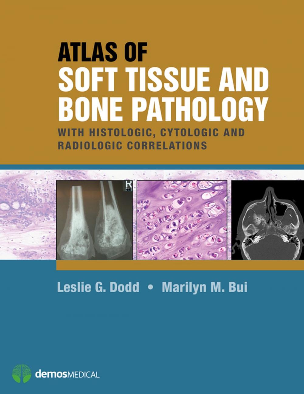 Big bigCover of Atlas of Soft Tissue and Bone Pathology