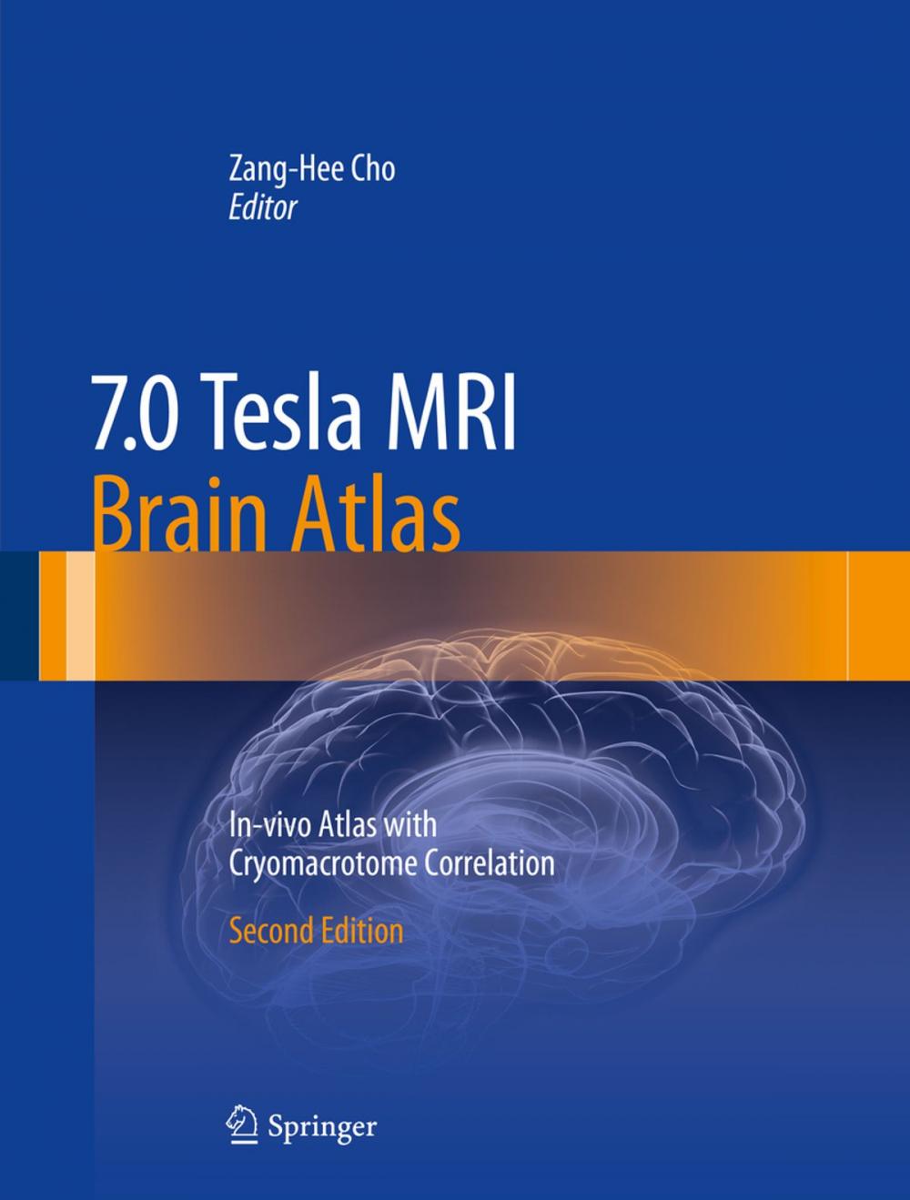 Big bigCover of 7.0 Tesla MRI Brain Atlas