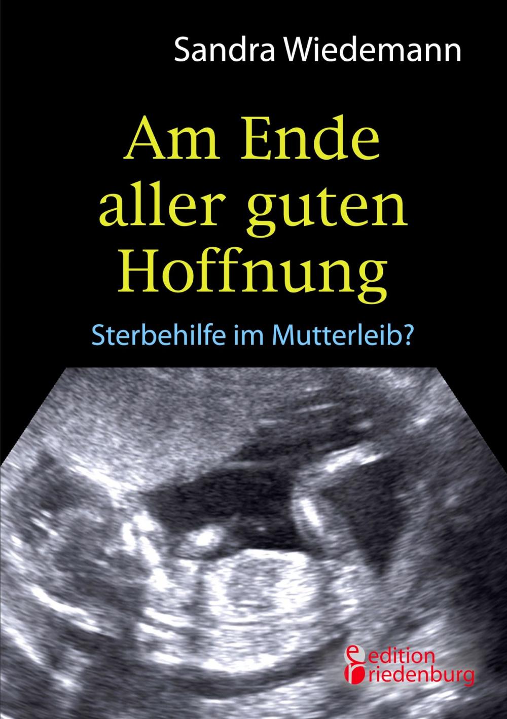 Big bigCover of Am Ende aller guten Hoffnung - Sterbehilfe im Mutterleib?