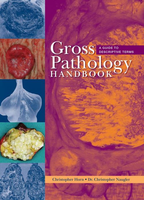 Cover of the book Gross Pathology Handbook by Christopher Horn, Christopher Naugler, Brush Education