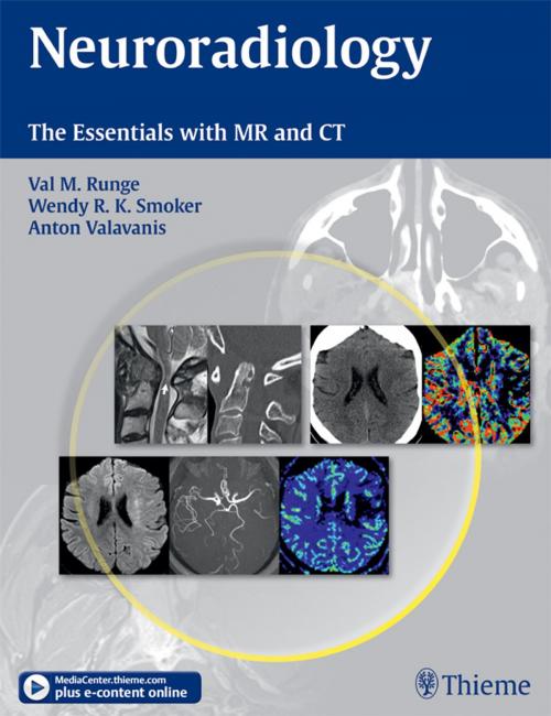 Cover of the book Neuroradiology by Val M. Runge, Wendy Smoker, Antonios Valavanis, Thieme