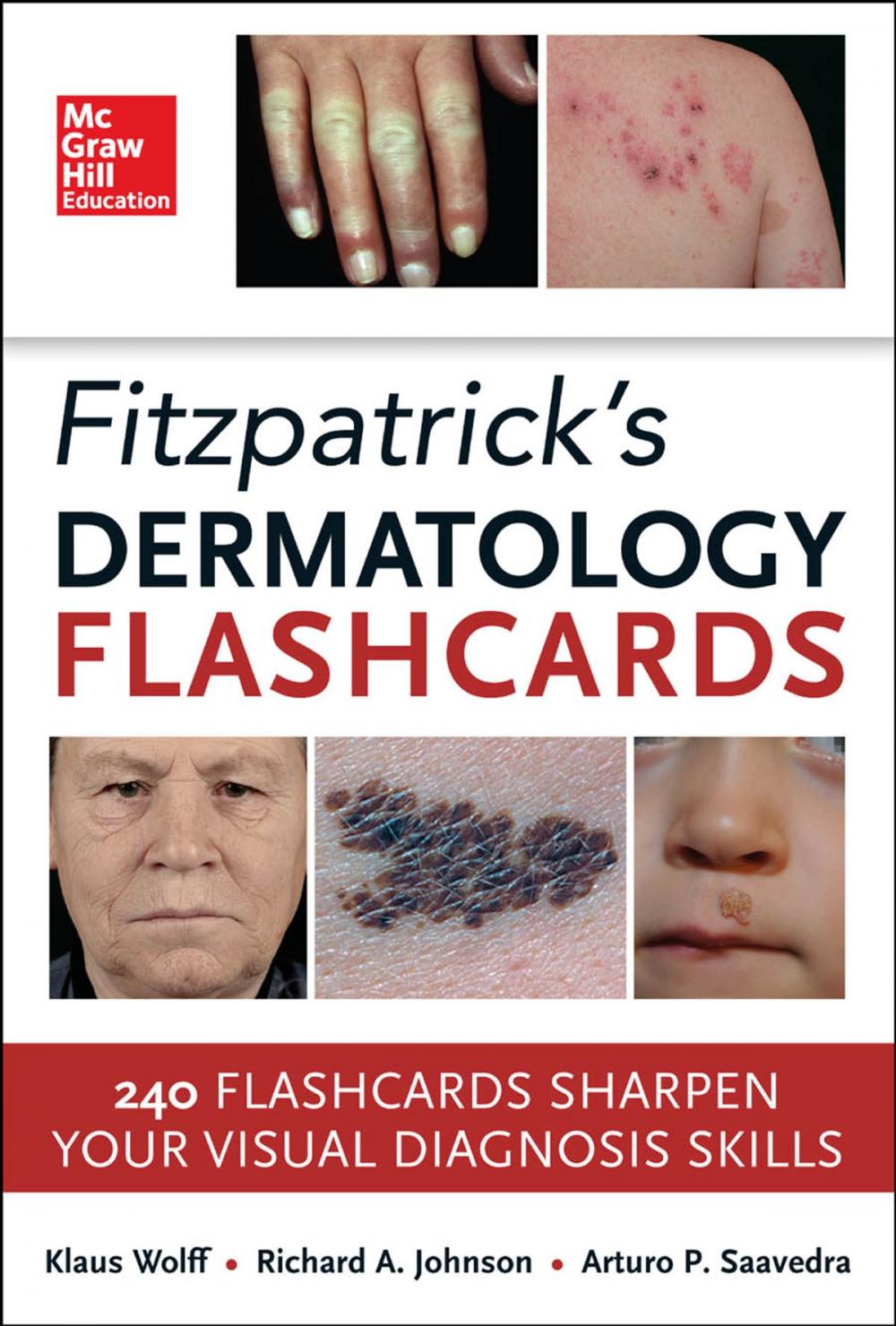 Big bigCover of Fitzpatricks Dermatology Flash Cards