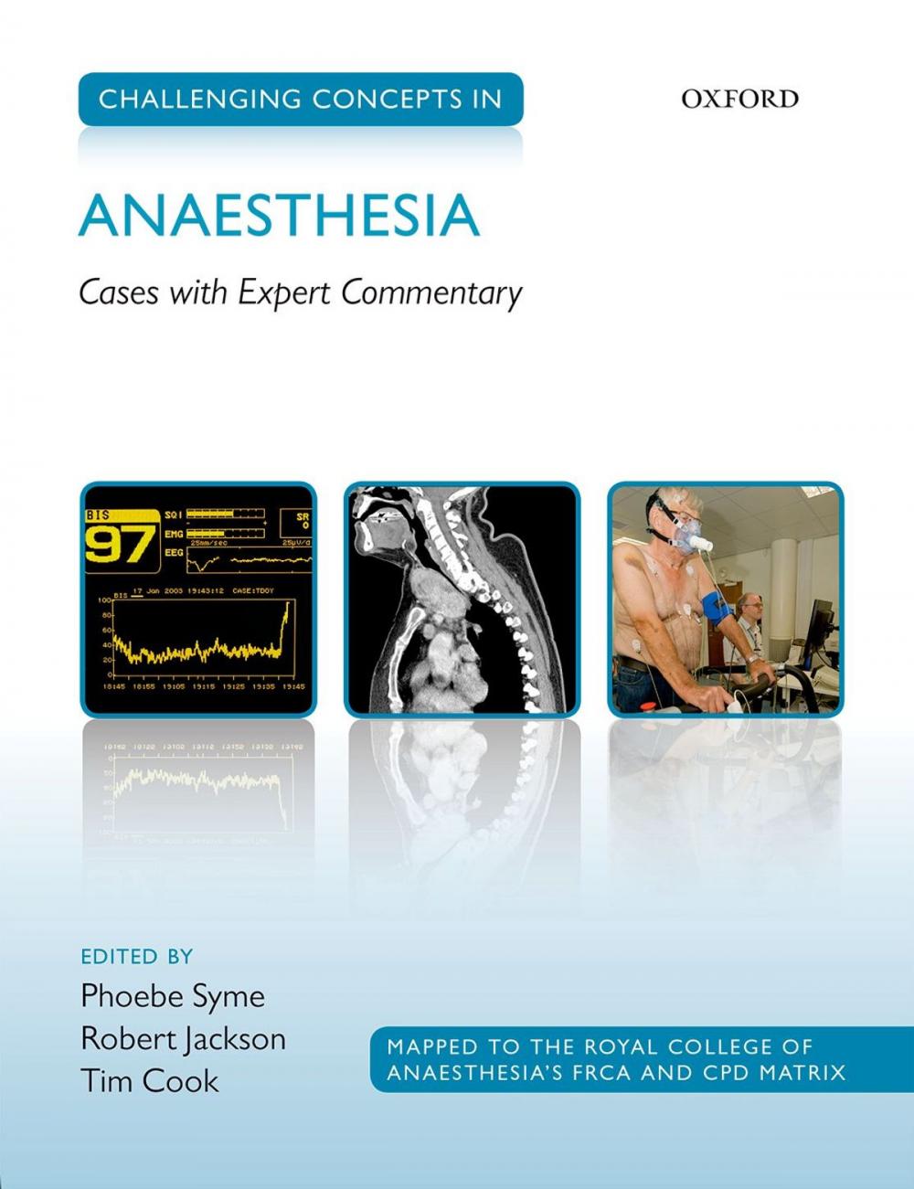 Big bigCover of Challenging Concepts in Anaesthesia