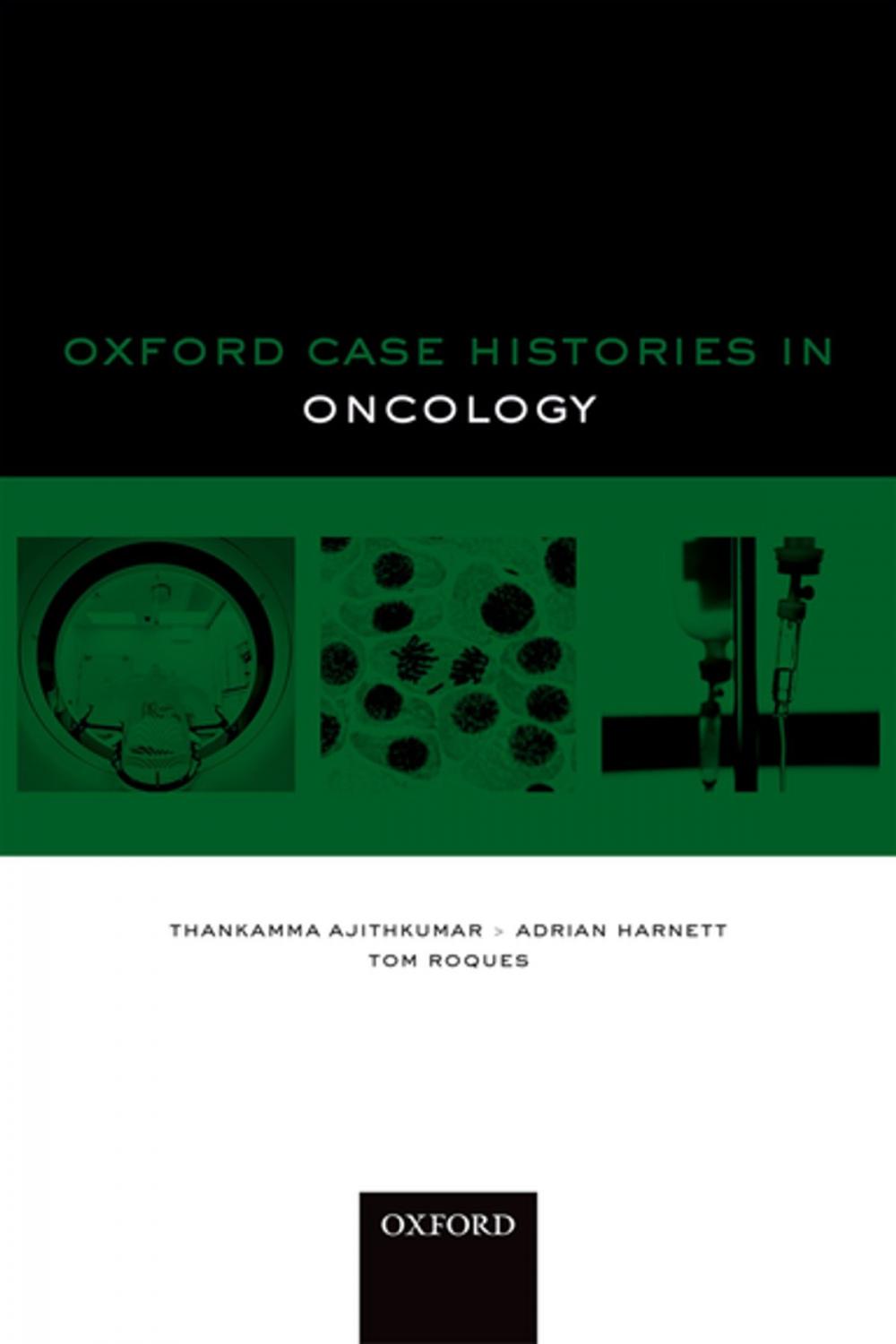 Big bigCover of Oxford Case Histories in Oncology