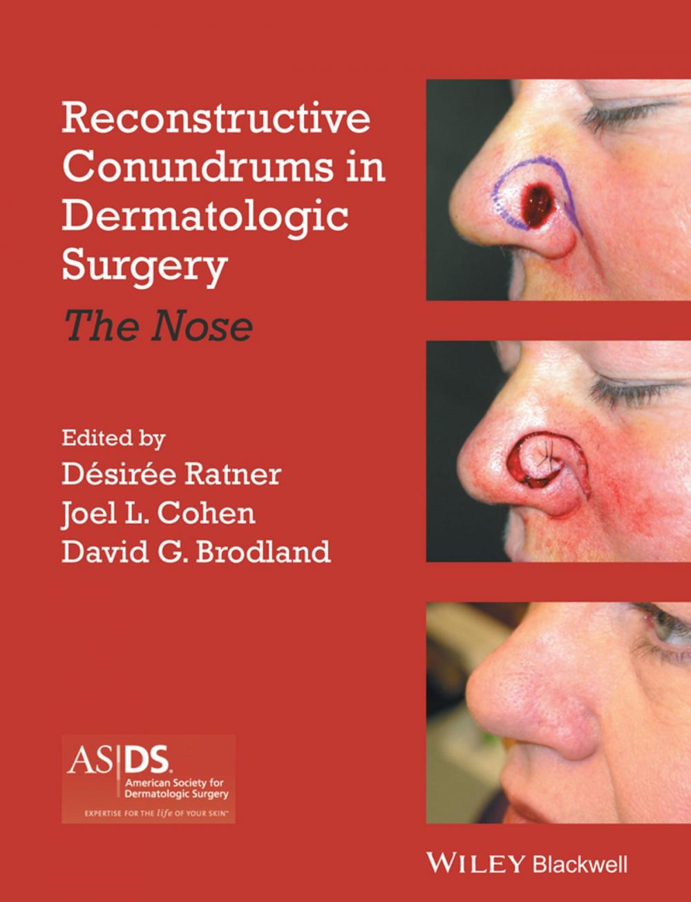 Big bigCover of Reconstructive Conundrums in Dermatologic Surgery