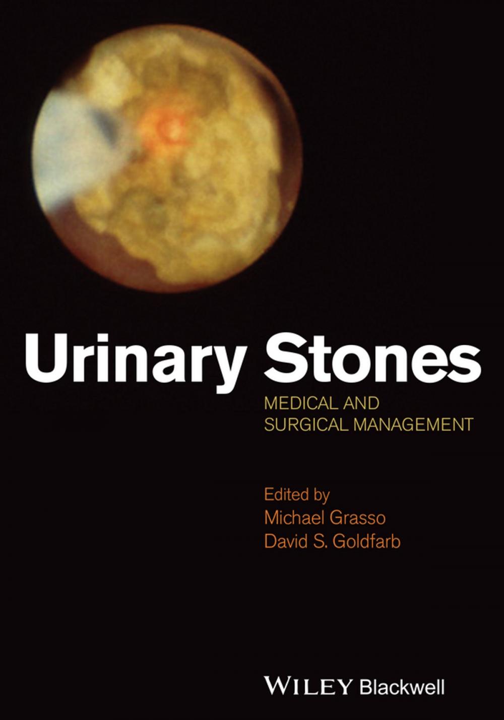 Big bigCover of Urinary Stones