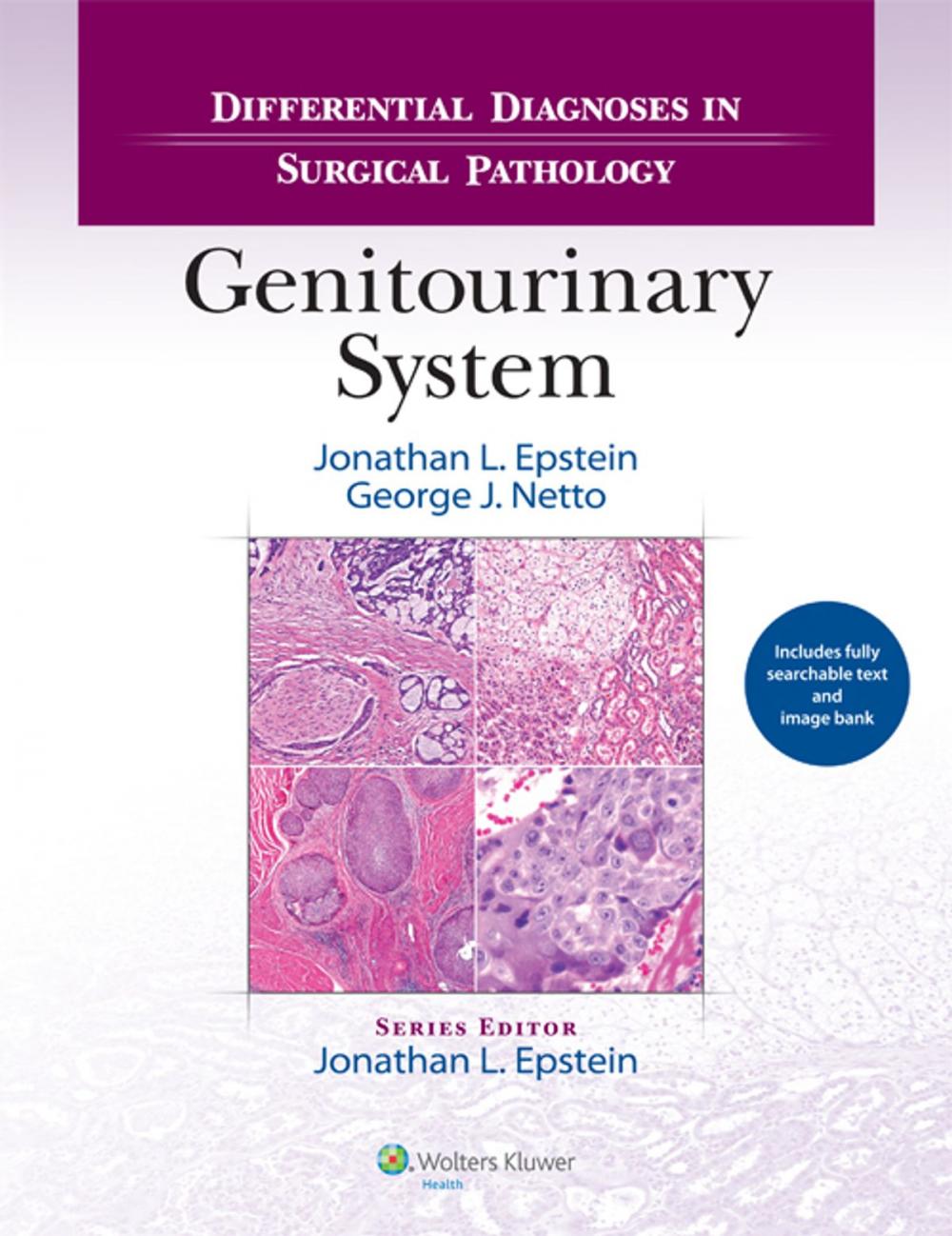 Big bigCover of Differential Diagnoses in Surgical Pathology: Genitourinary System