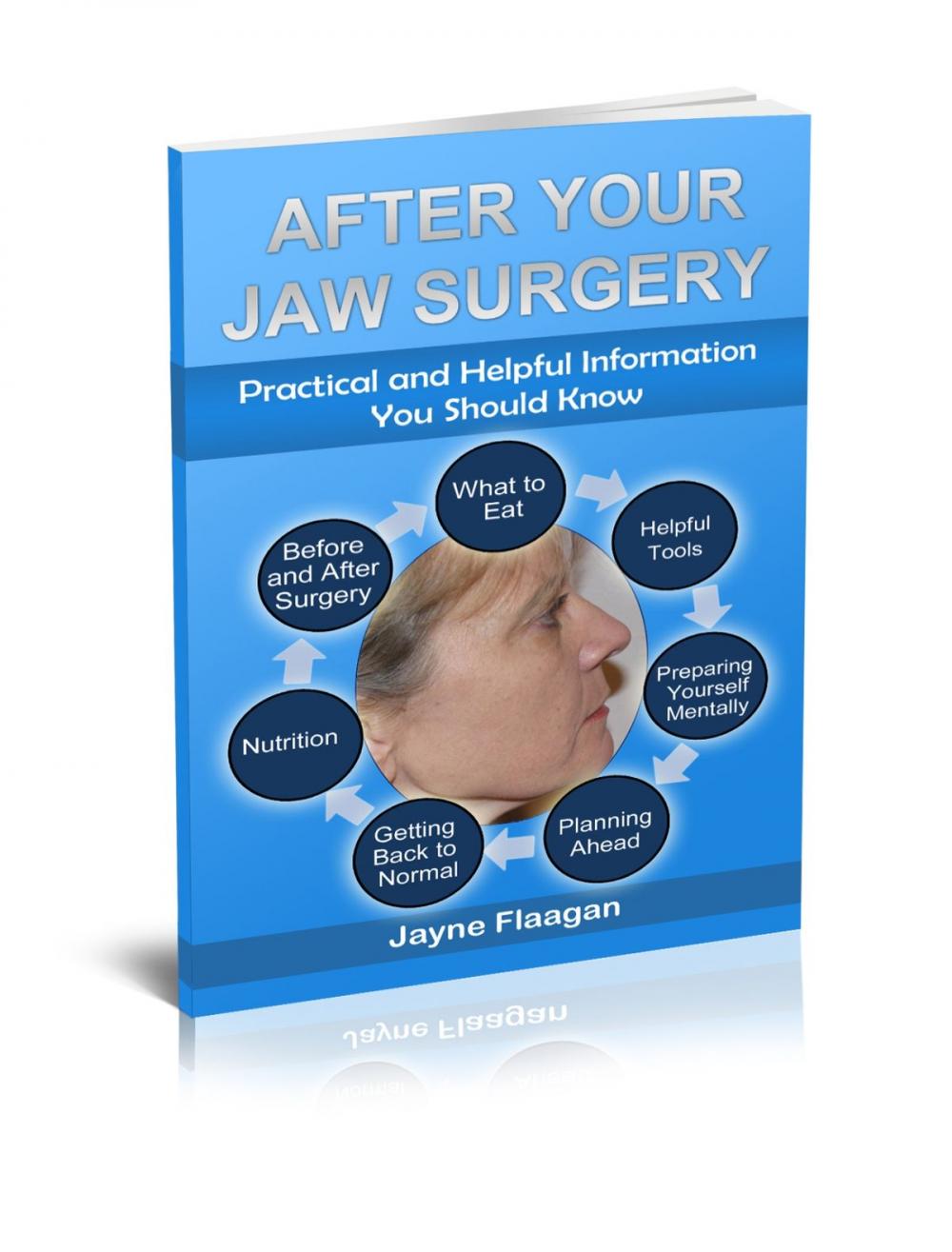 Big bigCover of After Your Jaw Surgery