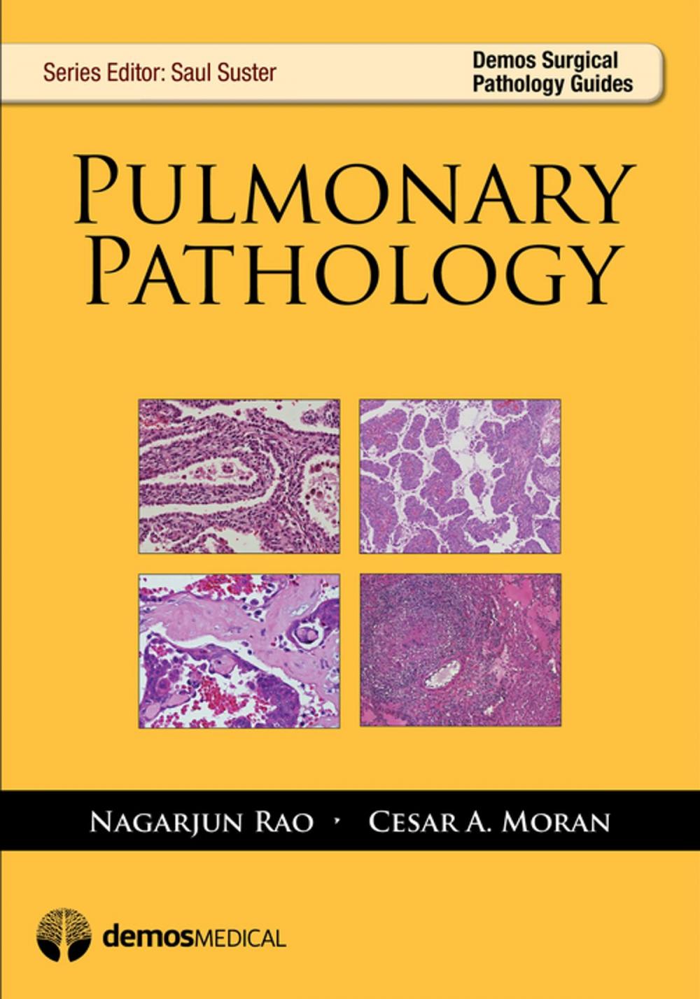 Big bigCover of Pulmonary Pathology