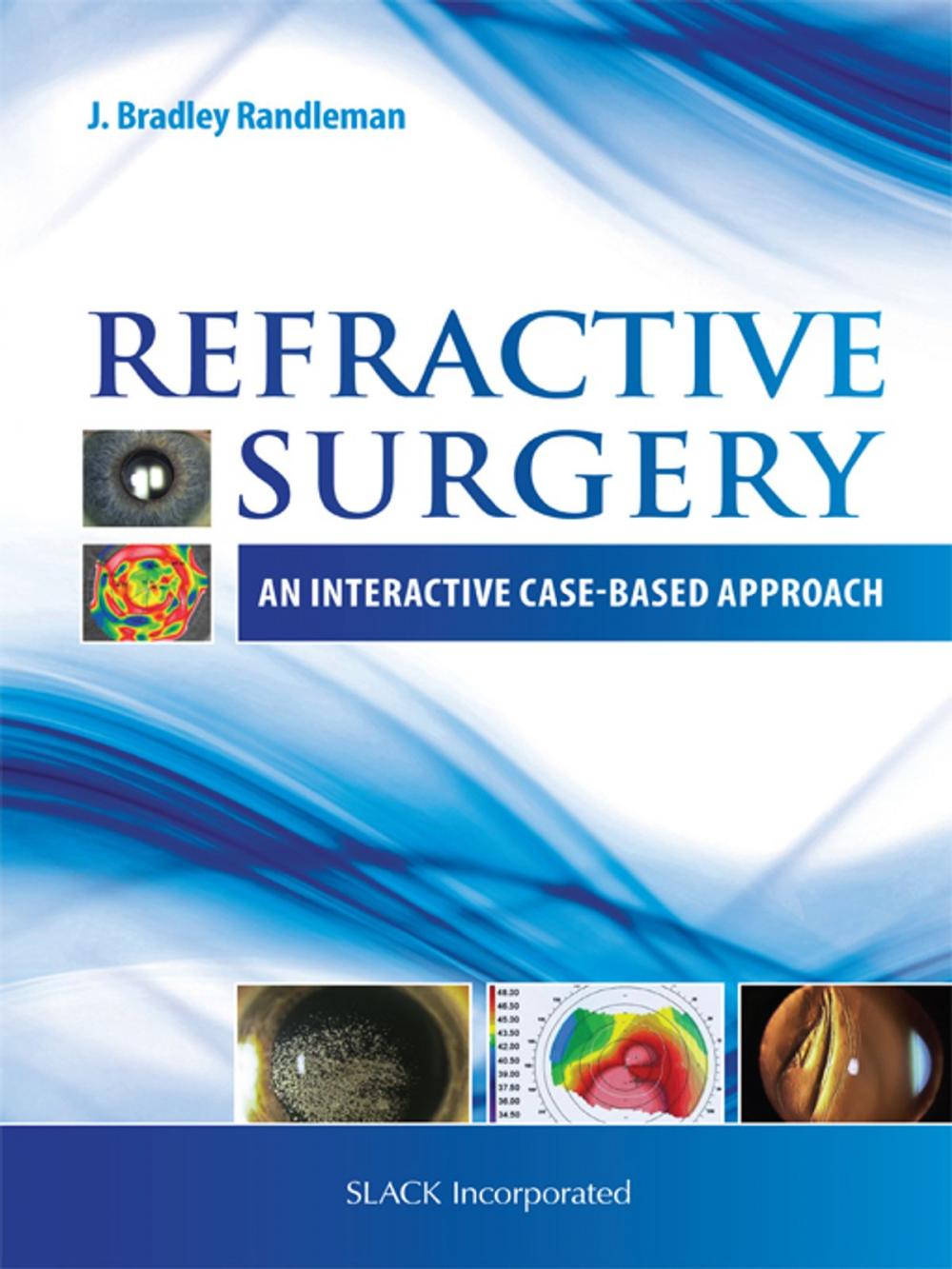 Big bigCover of Refractive Surgery