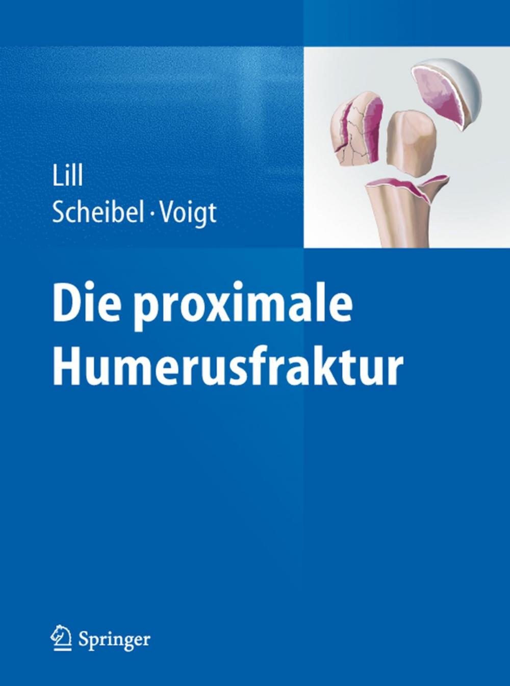 Big bigCover of Die proximale Humerusfraktur